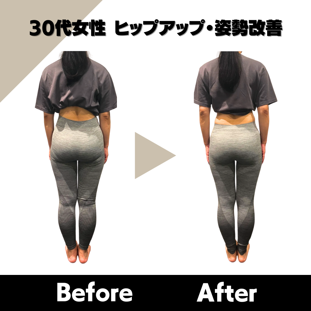 30代女性 ヒップアップ・姿勢改善