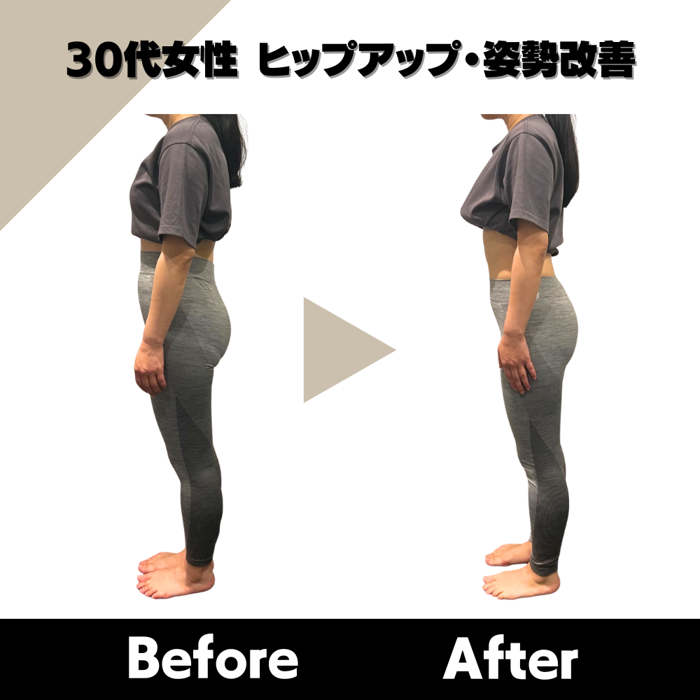 30代女性 ヒップアップ・姿勢改善